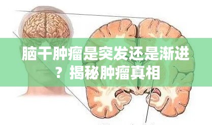 漫天飞舞